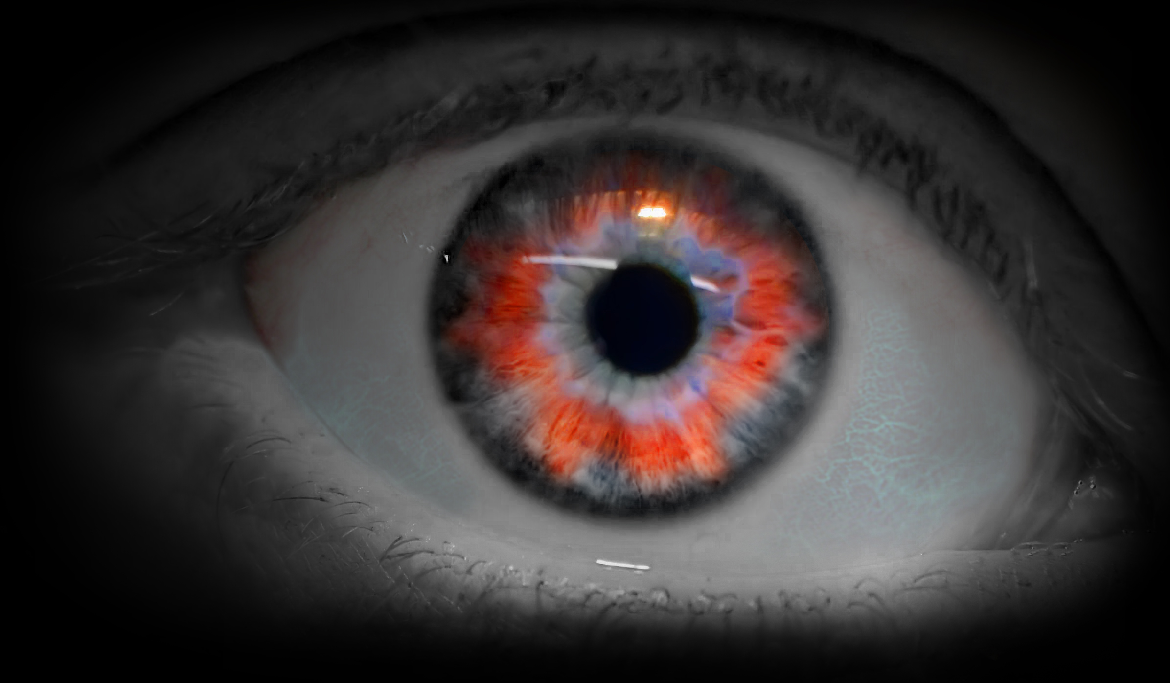 Göz Kanlanmasının Nedenleri Ve Tedavisi Hakkında Bilgiler