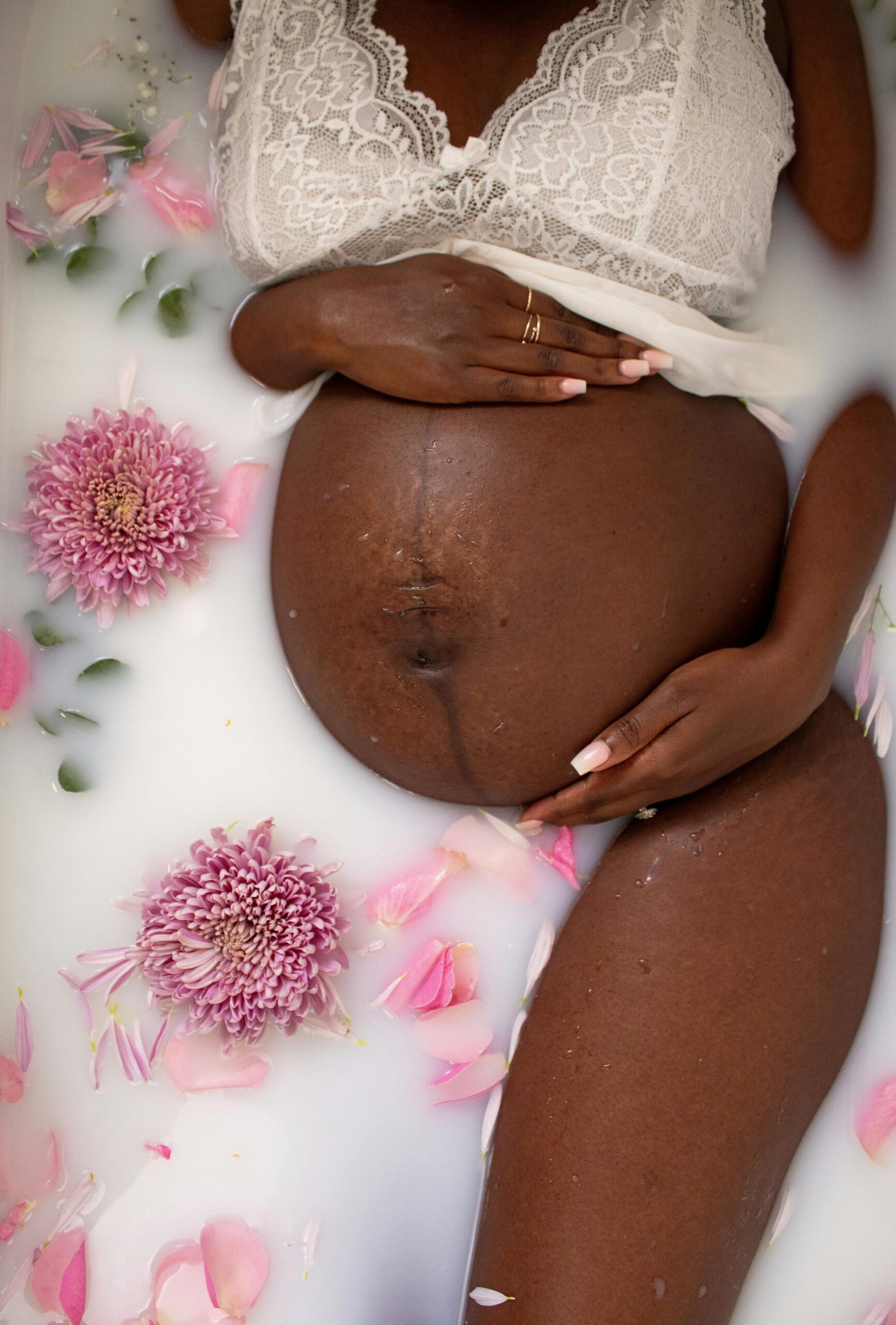 Cilt lekeleri çözümleri Cilt lekeleri çözümleri